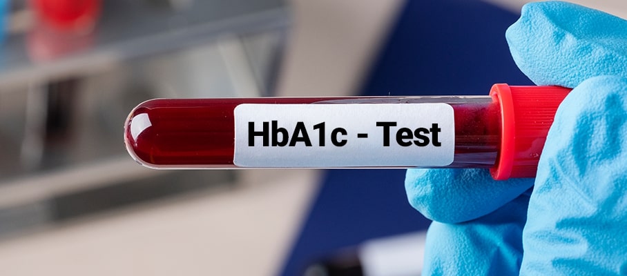 HbA1c Test for Diabetes: Importance, Range, Target and Results