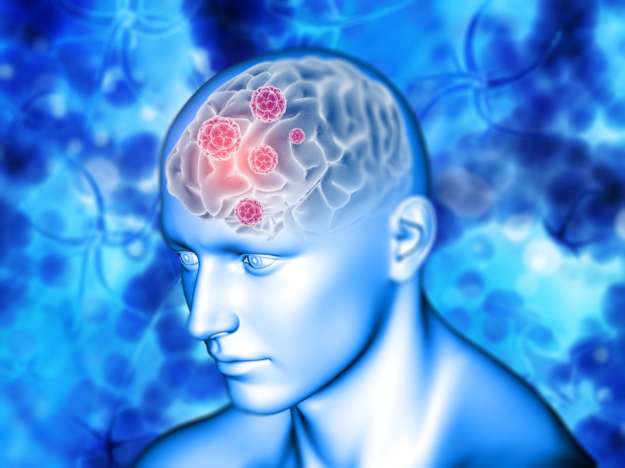 Haemorrhage: Types, Causes, Symptoms, Treatment