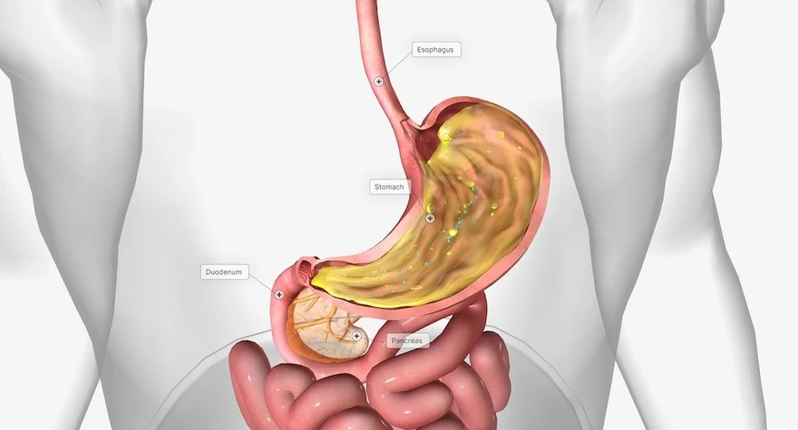 Understanding Hiatal Hernia: Symptoms, Causes, and Treatment Strategies!