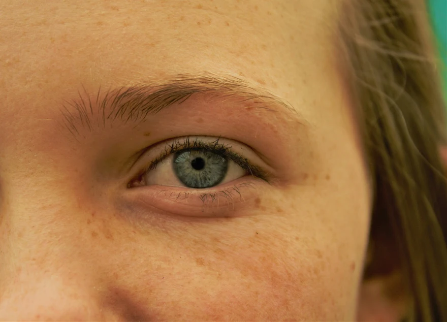 How to Remove Black Spots on Face: 10 Effective Home Remedies & Treatments