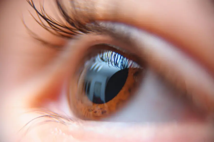 Iritis: Eye Inflammation Causes, Symptoms & How It's Treated