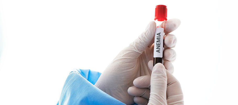 Could you have iron deficiency anemia? Find out here