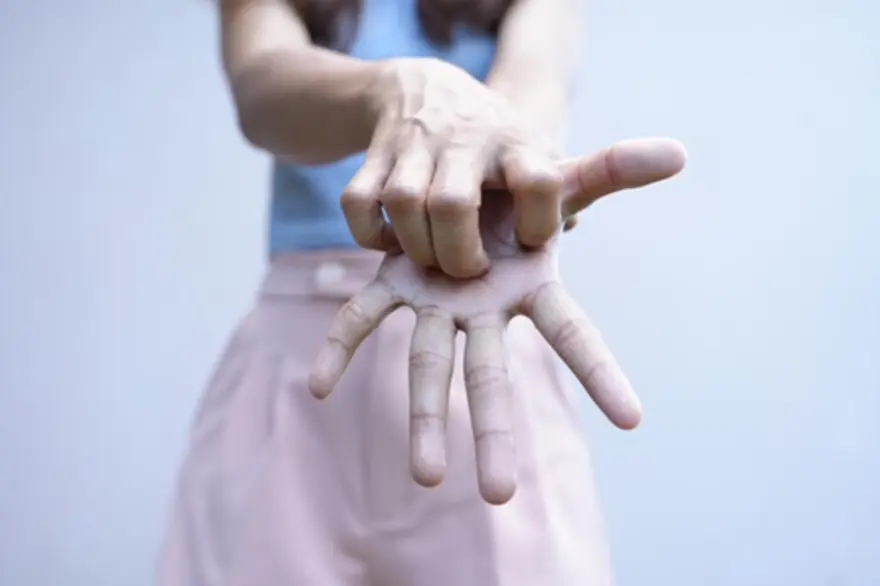 What is Ehlers-Danlos Syndrome? Causes, Symptoms, and Diagnosis