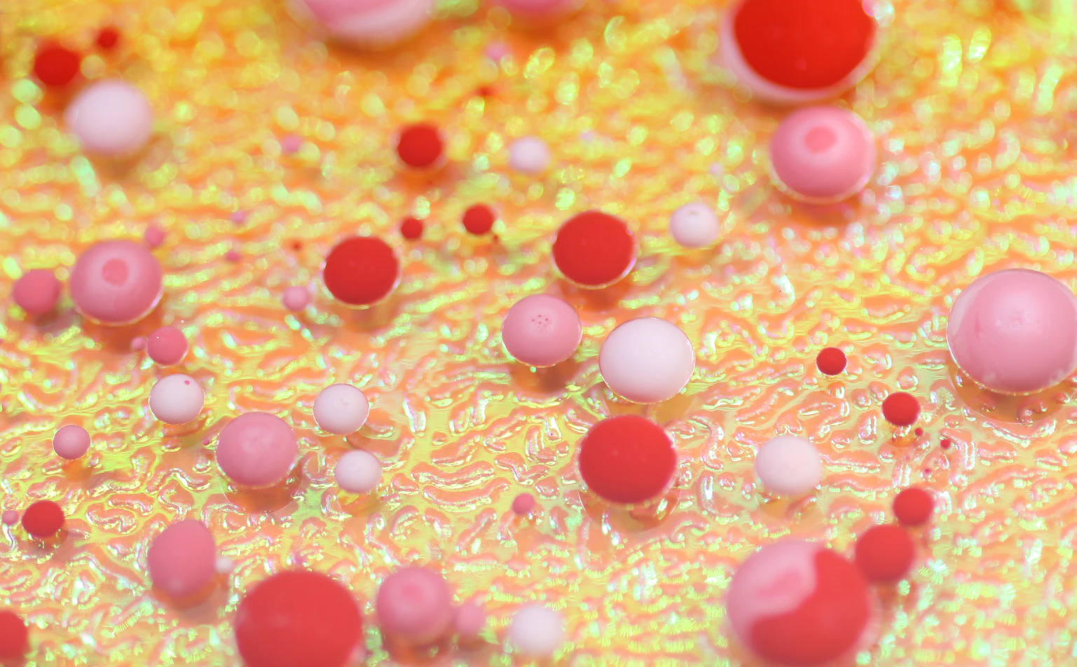 Leukopenia: Causes, Symptoms, Treatment and Types