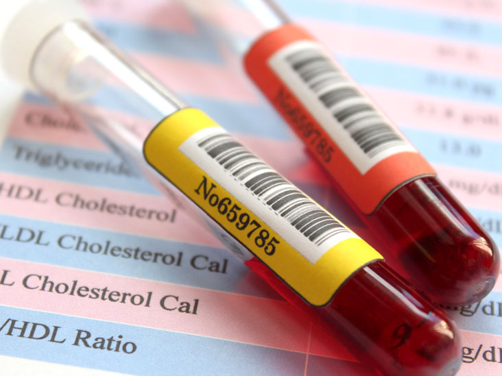 What is Lipid Profile Test?