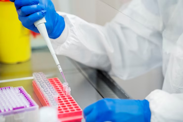 Malaria and Its Laboratory Tests: Diagnosis, Everything You Need to Know