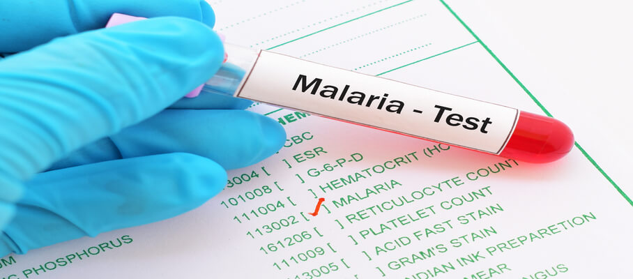 Malaria - Symptoms, Causes and Treatment
