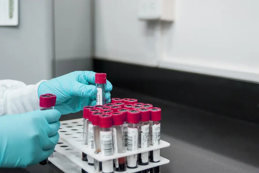 Understanding MCV Blood Test (Mean Corpuscular Volume): Normal Range, Low MCV & Results