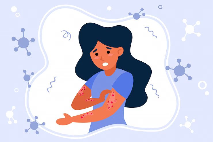 Melanoma: Symptoms, Signs, Causes, Treatment