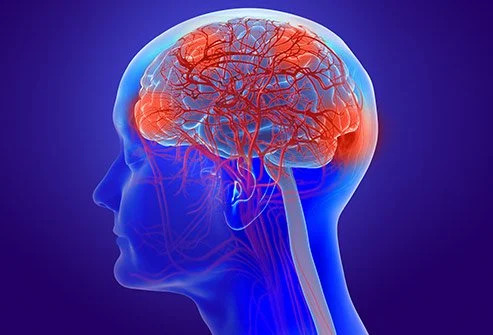 Metabolic Encephalopathy: Types, Symptoms, Causes, Diagnosis and Treatment