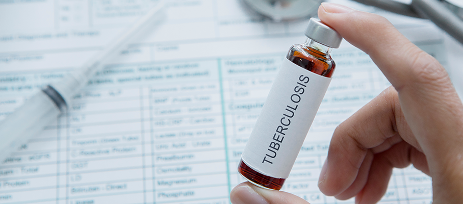 Different types of Drug Resistant Tuberculosis and Diagnosis