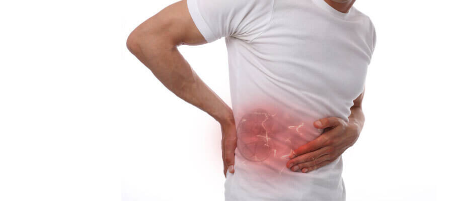 Kidney Stones: Causes, Treatment and Diagnosis Options