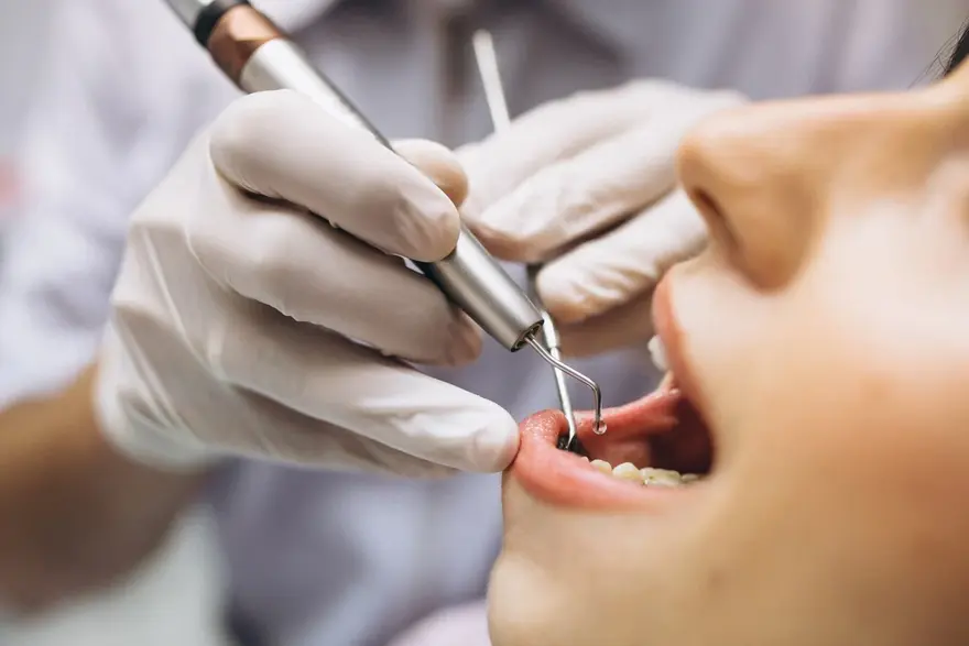 Mouth Cancer: Symptoms, Risk Factors, and Early Detection