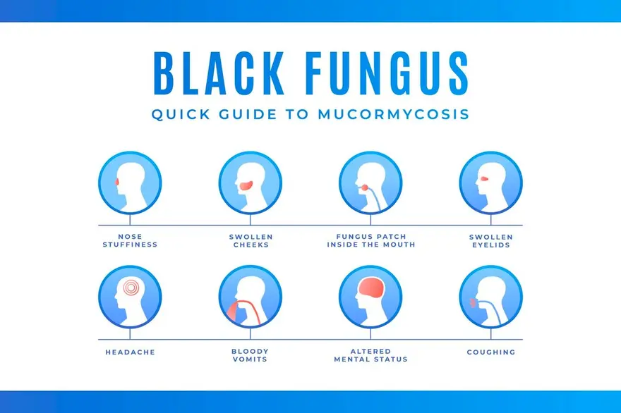 Understanding Mucormycosis: A Rare Fungal Infection