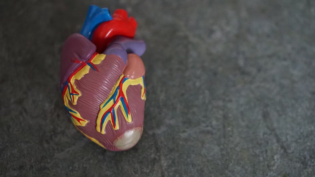 Myocardial Infarction: Symptoms, Treatment, Causes & Diagnosis