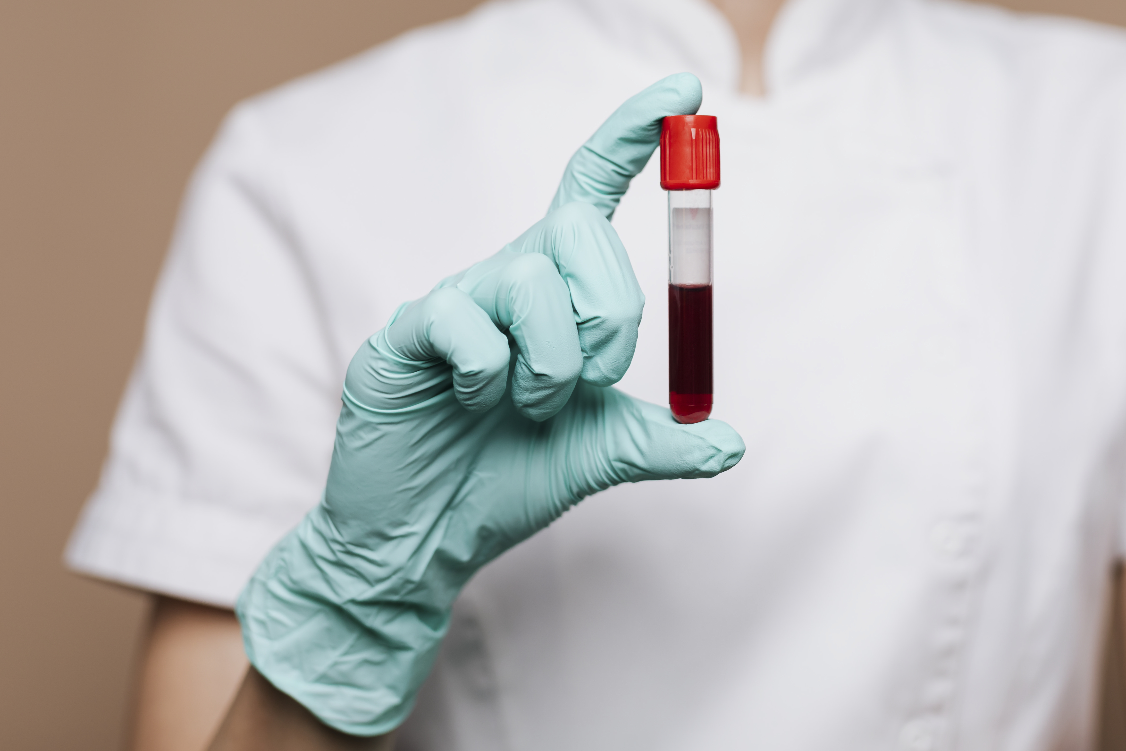Beta Thalassemia Test: Overview, Need, Procedure & Result