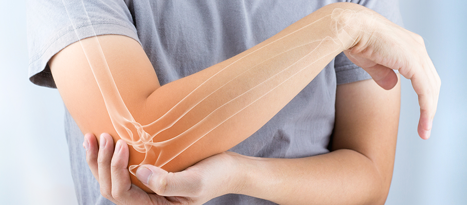 8 Things You Need To Know About Osteoporosis Prevention