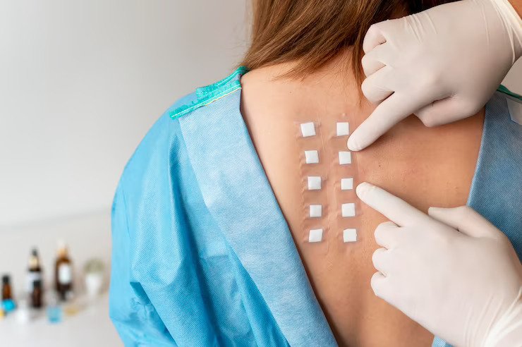 Patch Test: Cost, Procedure, Precautions, Side Effects & Results