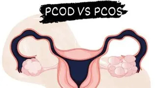 What is the Difference between PCOD vs. PCOS?