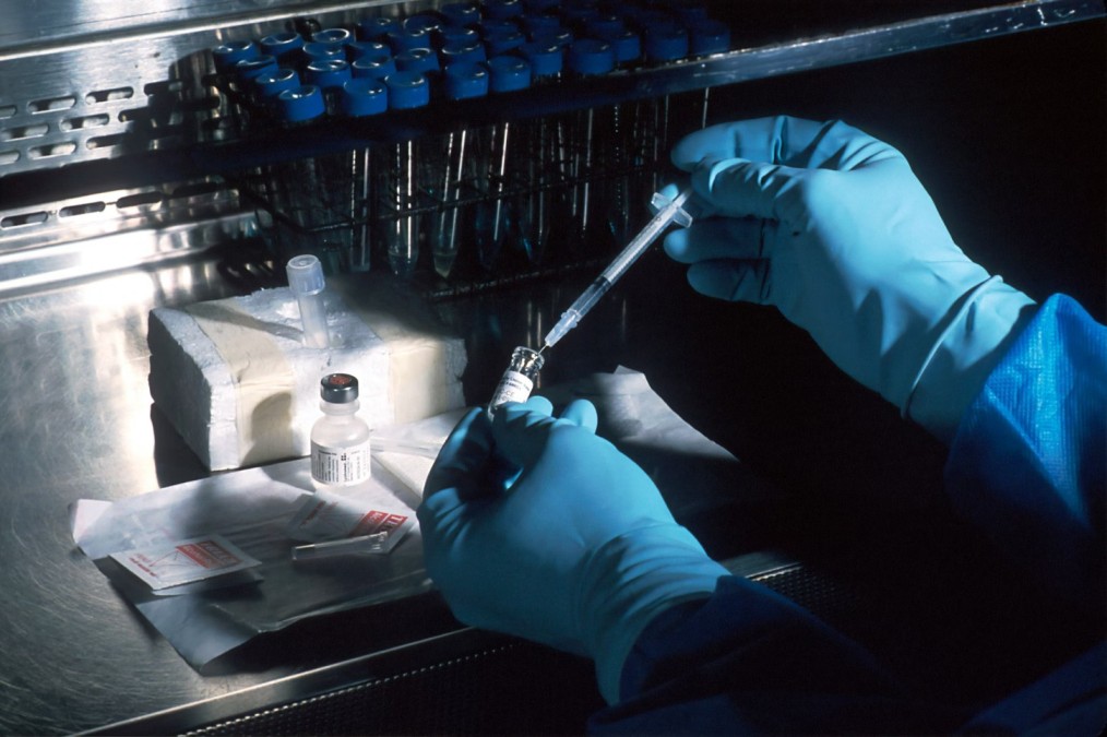 Amyloidosis: Everything You Need to Know