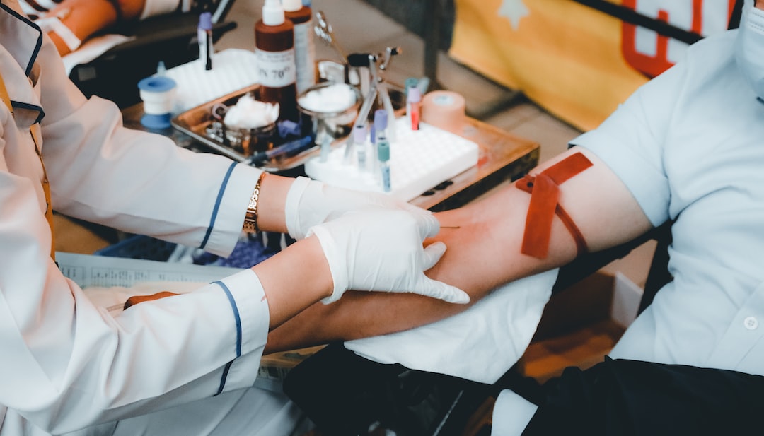 Alcohol Blood Tests: Types, Benefits & Procedure