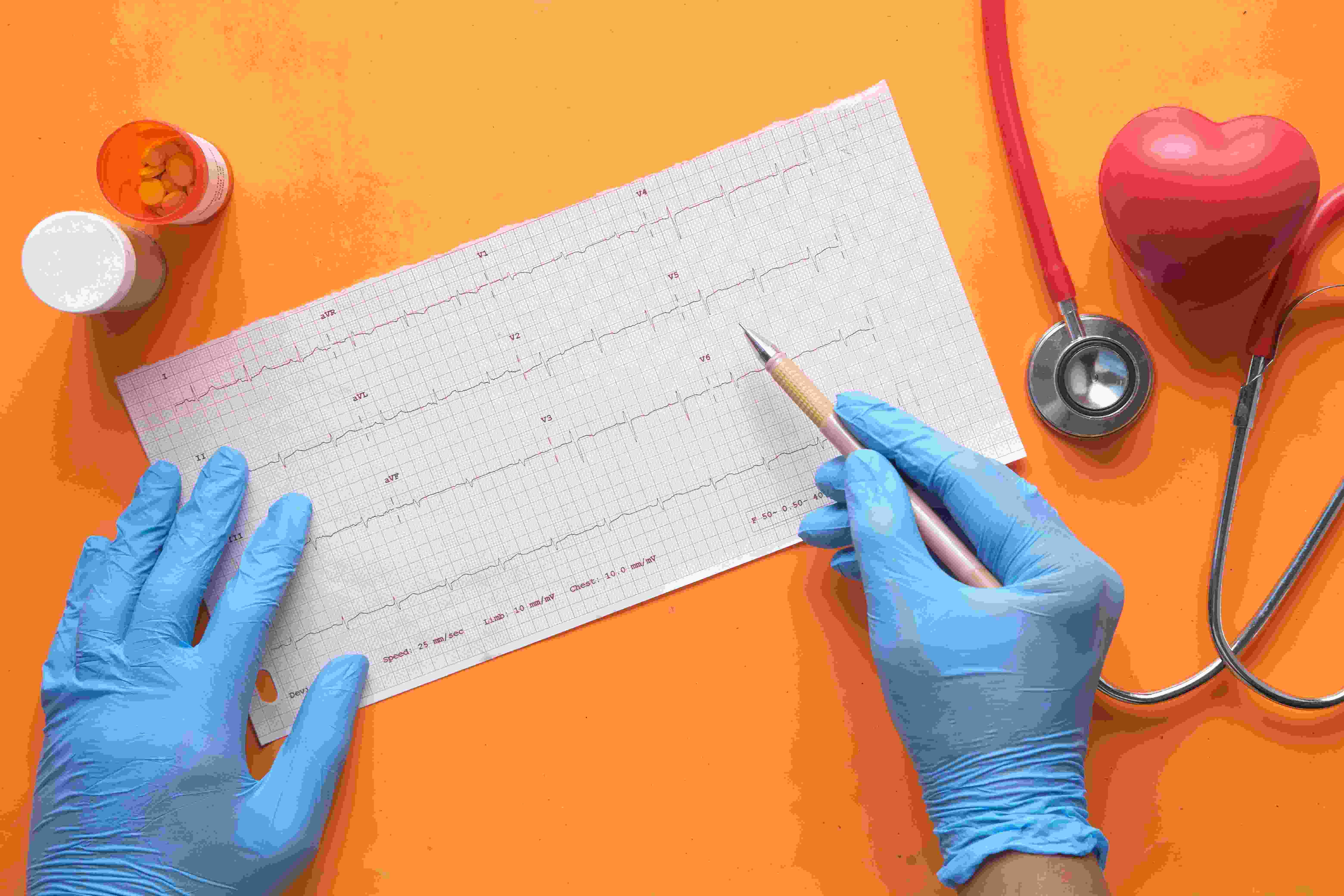 Life-Threatening Blood Clots: Understanding The Causes, Symptoms and Prevention of Thrombosis