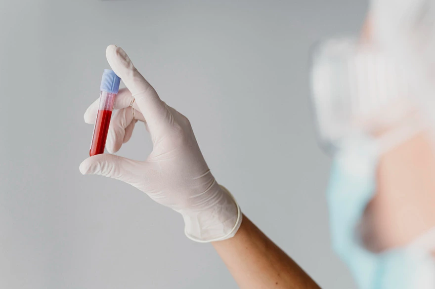 Procalcitonin (PCT) Test: What You Need to Know & Results
