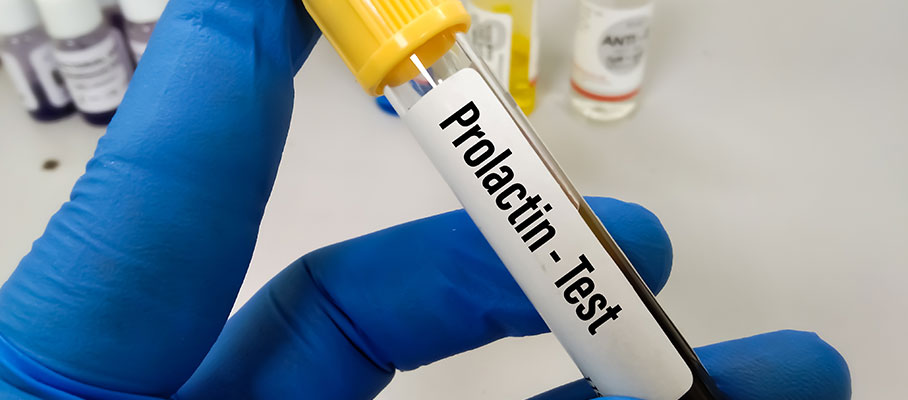 Prolactin Test: Normal Range, High vs Low and Results By Age