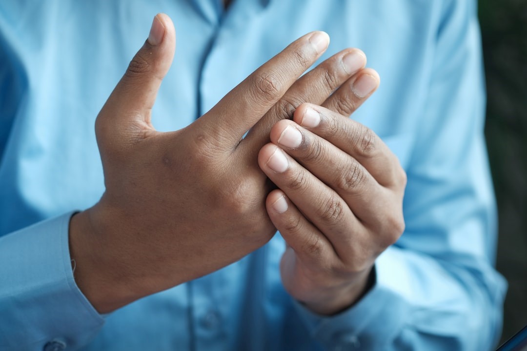 What is Psoriatic Arthritis: Symptoms, Treatment & Causes