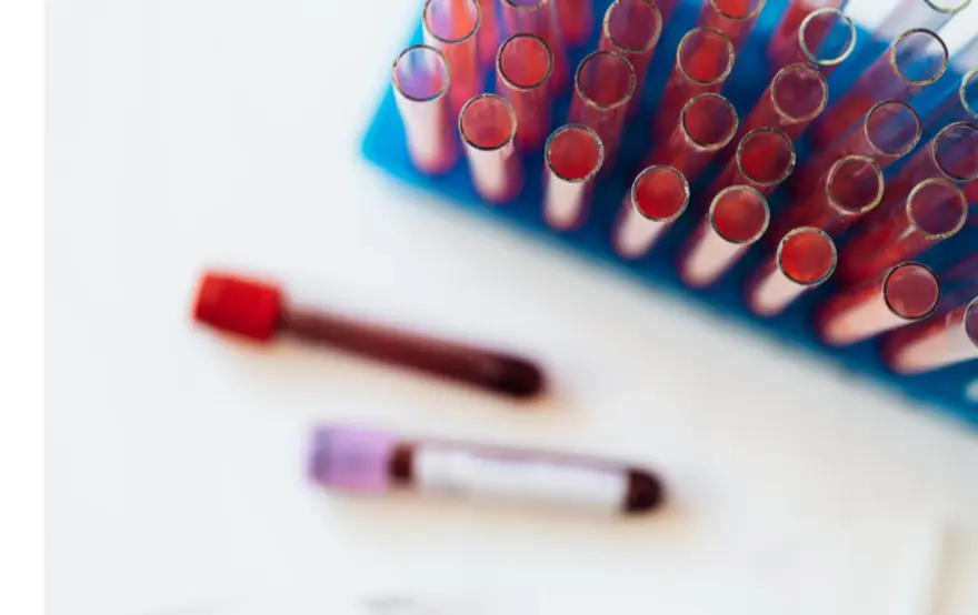 Understanding RDW Blood Test: Normal Range and Interpretation