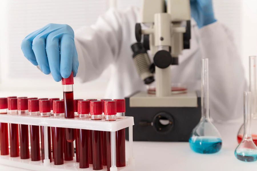 What is Sepsis: Symptoms, Causes, and Treatment of Blood Infection
