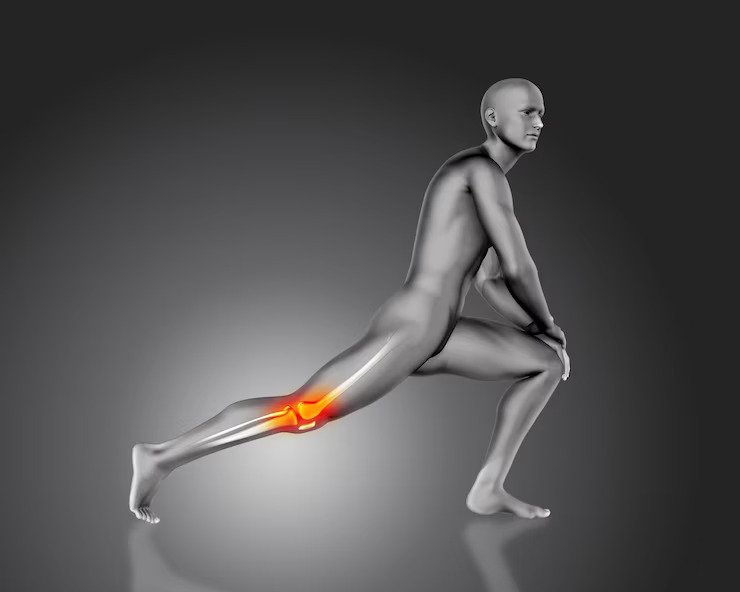 Septic Arthritis: Symptoms, Causes, Risk Factors & Treatment Options