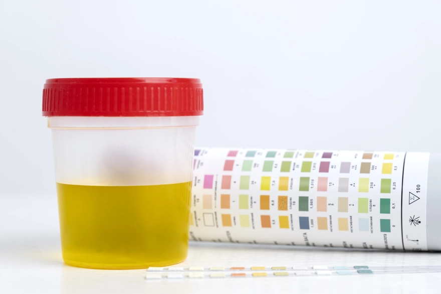 Smelly Urine: Causes, Symptoms, and How to Treat It