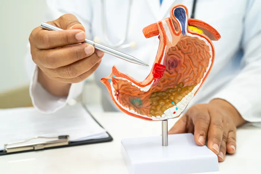 Stomach Cancer: Symptoms and Diagnosis
