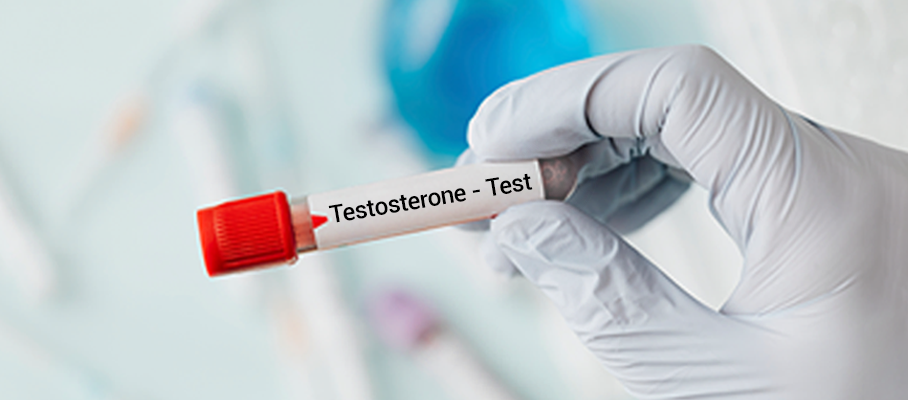 Testosterone Test: When to Get Tested & What Results Mean
