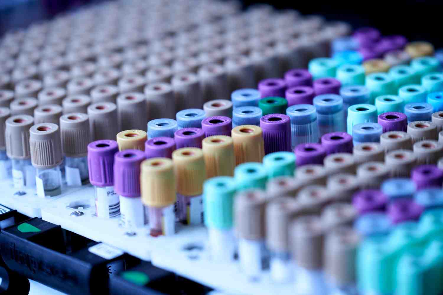 Thalassaemia Testing: Importance of Screening & Treatment Options