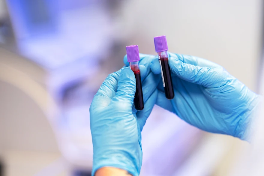 TIBC Test: What It Measures and When It's Needed