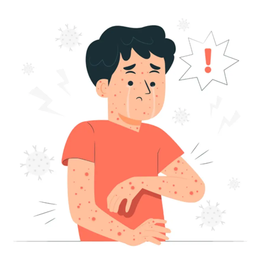 Tomato Flu: Signs, Symptoms, Causes, Prevention and Treatment