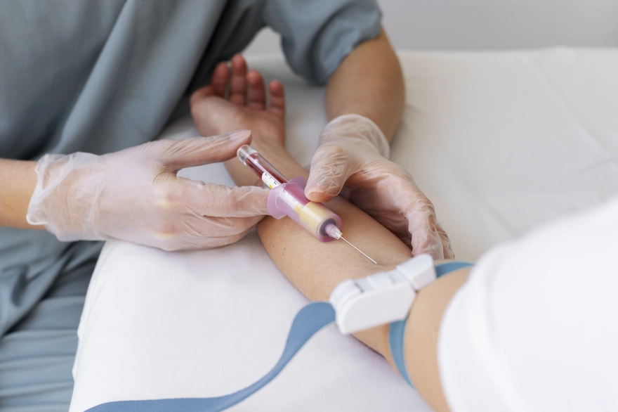 Transferrin Test: Iron Levels and Anemia Diagnosis