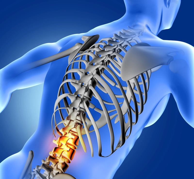 Transverse Myelitis: Symptoms, Causes & Treatment