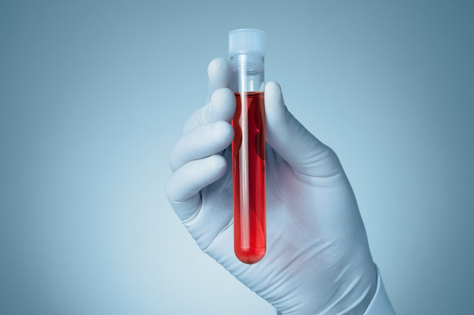 TSH Test: Usage, Procedure, Levels and Results