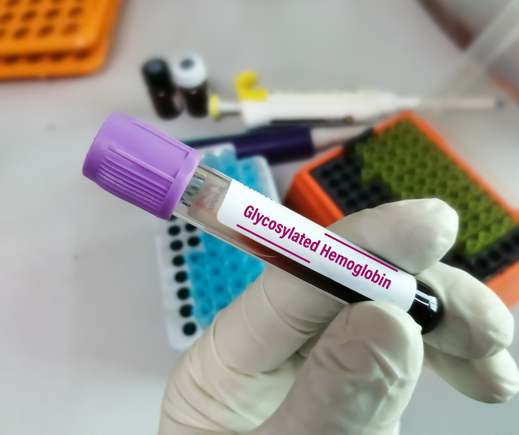 What is Glycosylated Hemoglobin (HbA1c): Levels, Normal Range Explained