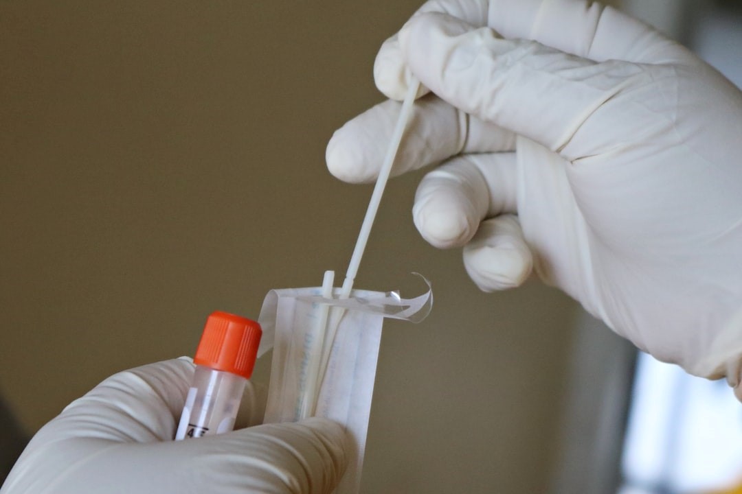 Dark Yellow Colour Urine : Causes, Symptoms, What Is The Reason & What does it Indicate?