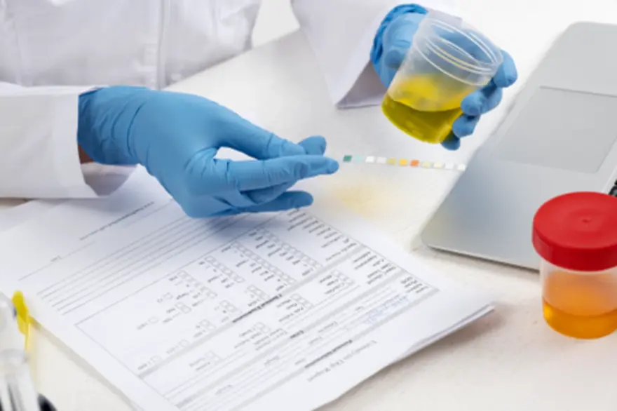 Urine Culture Test: Procedure, Preparation and Results