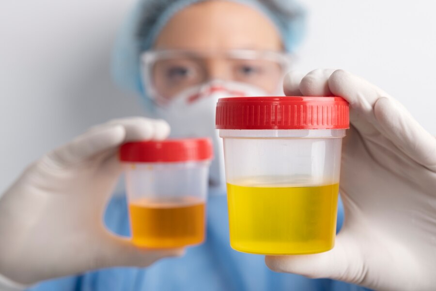 Understanding the Urine Color Chart