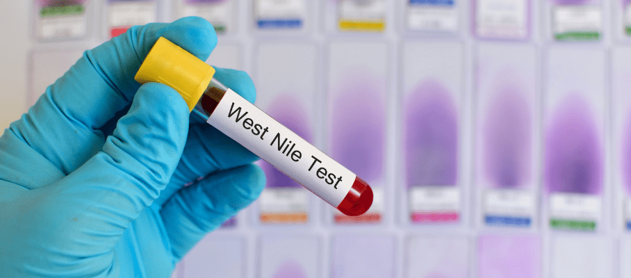West Nile Virus: Symptoms, Risks, and Understanding West Nile Fever