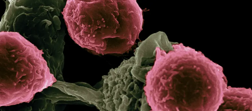 Signs & Symptoms Of HIV in Men & Women