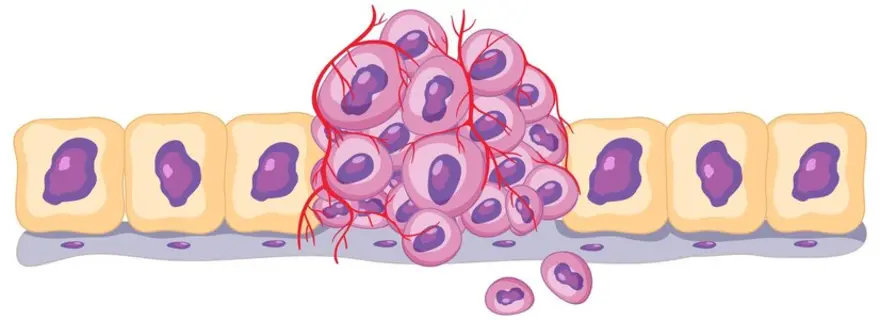 Exploring Tumor Markers: Types, Tests, and Uses
