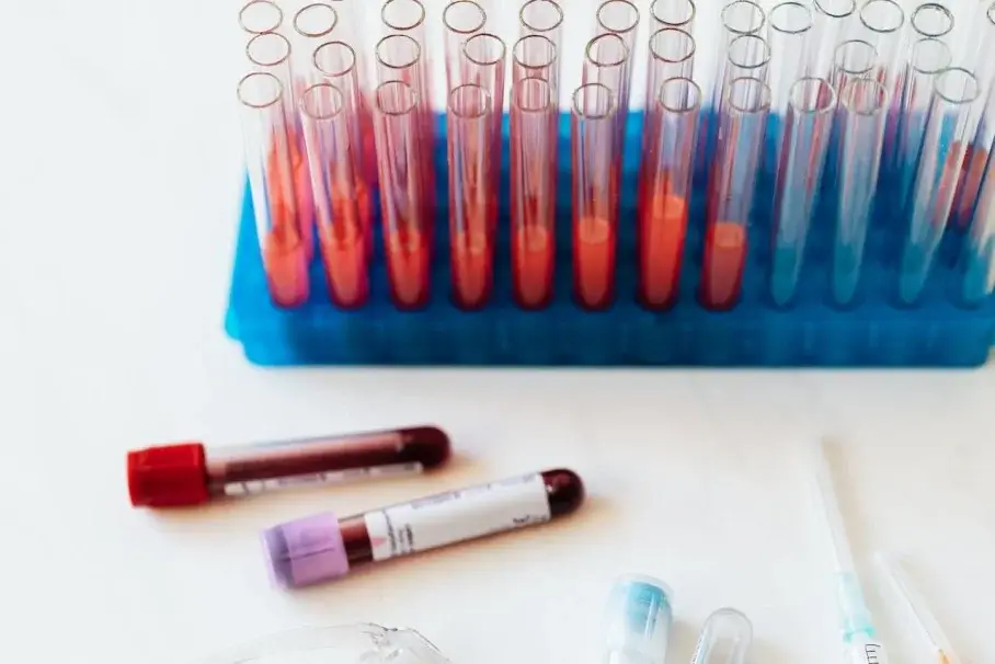 SHBG Test: Purpose, Normal Range, Procedure & Results Explained