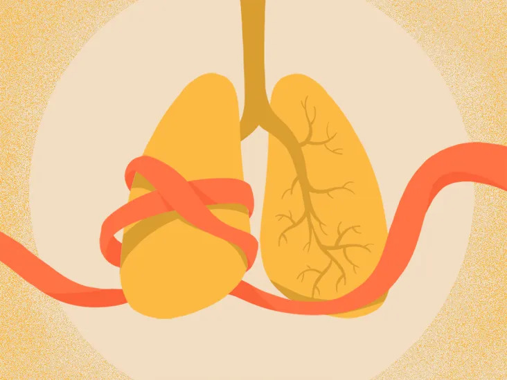 What Is COPD: Learn About Diagnosis Treatments and More